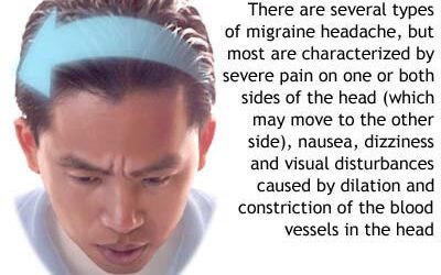 Craniosacral for Migraines? By Sharon Hartnett