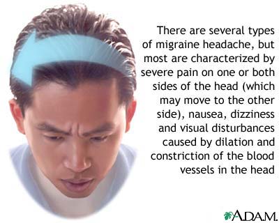 Craniosacral Migraine Columbus