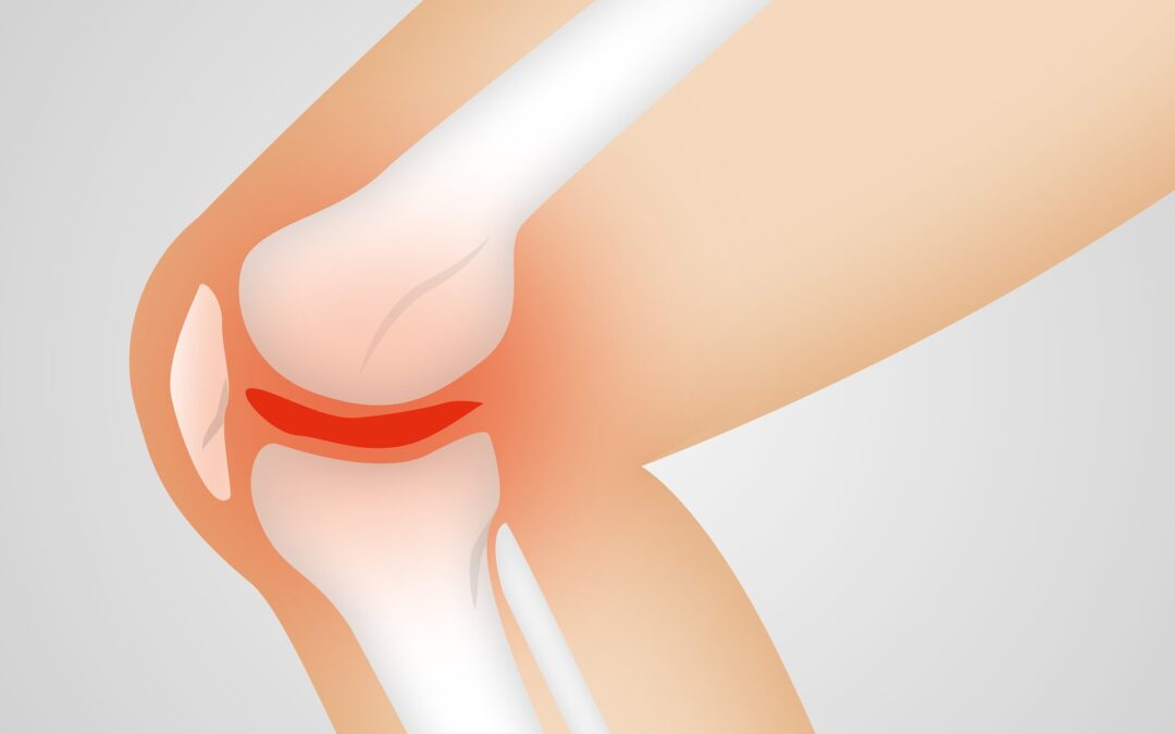 Resolving Knee Pain Issues