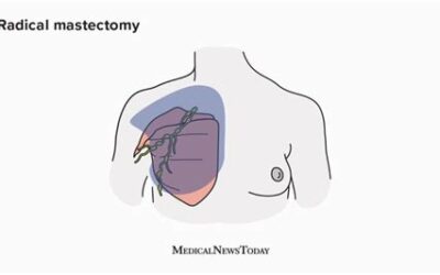 Unlocking the Healing Energy of Your Heart After a Masectomy